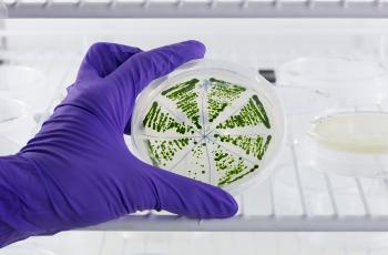 Colonies de microalgues sur boîte de Petri